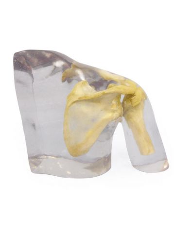 X-ray phantom shoulder, transparent
