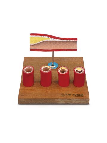 Artery Model with 4Cross Section