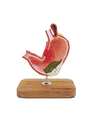 GStomach Cancer model