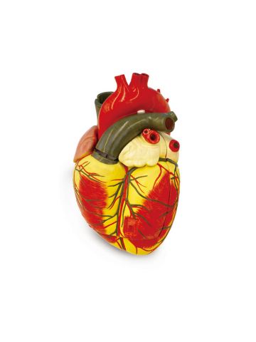 Enlarged Heart Model 3 Parts