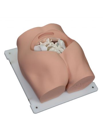 Bonnie Bone Marrow Biopsy